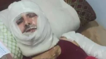 زوجة ضحية الدفاع عن منزله في كفر الشيخ تؤكد تعرضه لحرق عمد باستخدام البنزين 1